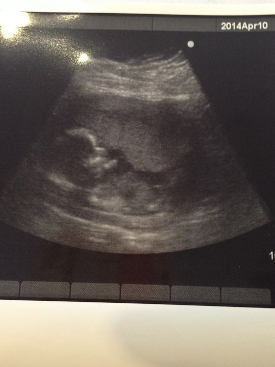  photo 16weeks_zps05446381.jpg