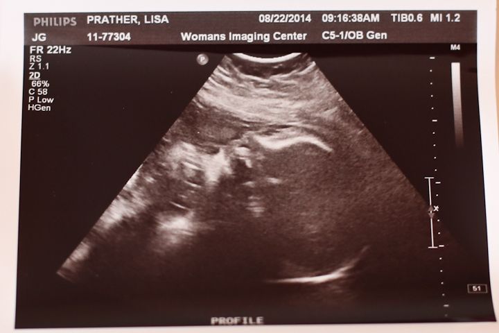 photo Avery35WeekUltrasound-2_zps41234328.jpg