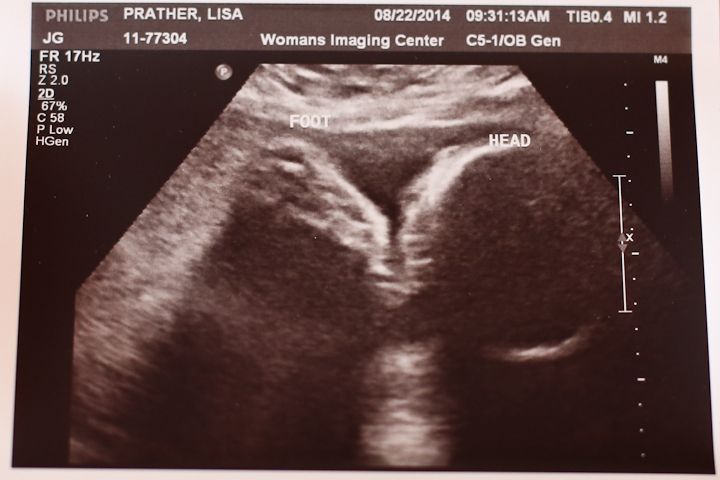  photo Avery35WeekUltrasound-3_zps779cf88c.jpg
