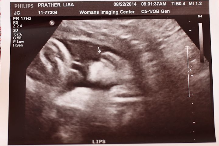  photo Avery35WeekUltrasound-4_zps6b2e7634.jpg