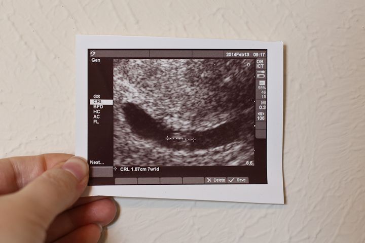  photo 7WeekUltrasound_zps120ae1bb.jpg
