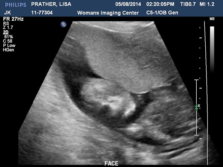  photo Ultrasound-8_zpse90436f5.jpg